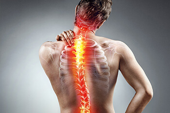 Scoliosis